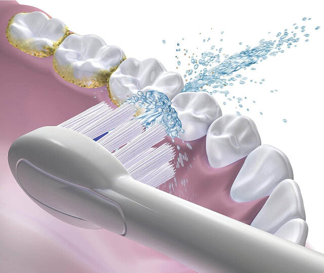 Waterpik Sonic-Fusion Zahnbürste mit integrierter Munddusche 2-Minuten Timer + 2 Bürsten Mundgesundheit Zahnreinigung Zähneputzen Zahnpflege