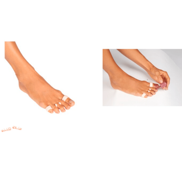 Zehentrenner 2er Pack Nagellackschutz Lackierhilfe Fußpflege Zehenspreizer Fuß Pediküre Helfer Restposten