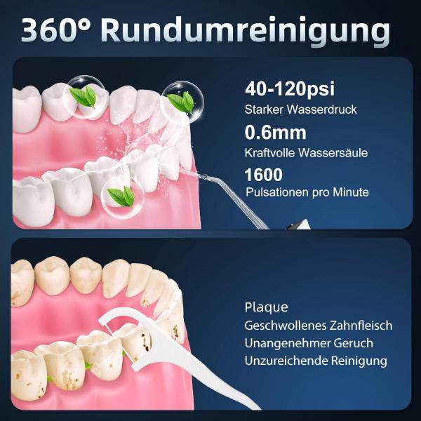 IVISMILE Kabellose Munddusche – 300 ml Tank, 4 Modi, 5 Jet-Düsen, IPX7 wasserdicht – Weiß – Großhandel / Gesamtabnahme