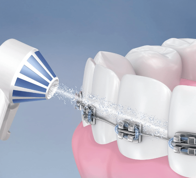 Oral-B ED17-4 OxyJet Ersatzbürstenköpfe – Aufsteckdüsen für OxyJet Munddusche – Neuware